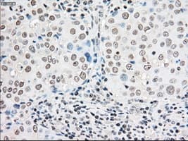 Monoclonal Mouse anti-Human BRAF / B-Raf Antibody (clone OTI1G6, IHC, WB)