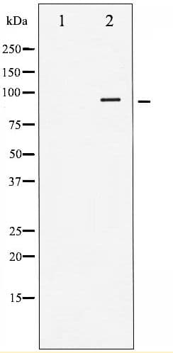 INSR / Insulin Receptor Antibody (phospho-Tyr1355)