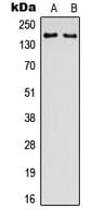 GRIN2D / NMDAR2D / NR2D Antibody (Internal)