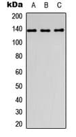 Polyclonal Rabbit anti-Human COL1A1 / Collagen I Alpha 1 Antibody (C-Terminus, WB)