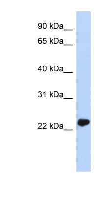 UCHL3 Antibody (N-Terminus)