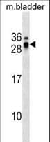 ECSCR Antibody (aa137-165)
