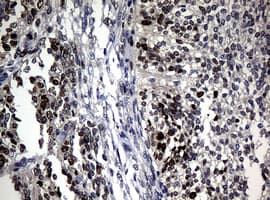 PCNA Antibody (clone OTI8C12)