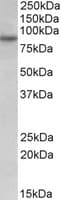 IHC-plus™ RUFY1 Antibody (aa479-491)