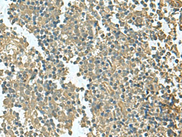 Polyclonal Rabbit anti-Human KRT36 / Keratin 36 / KRTHA6 Antibody (IHC, WB)
