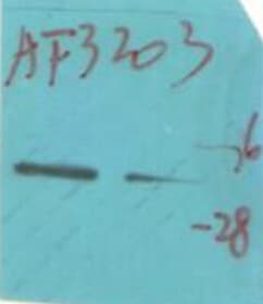 IGFBP3 Antibody (phospho-Ser183)