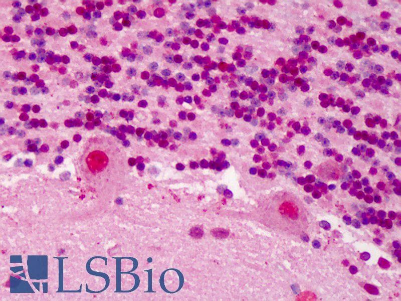 IHC-plus™ Polyclonal Rabbit anti-Human RBX1 / ROC1 Antibody (aa94-108, IHC, WB)