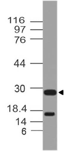 Monoclonal Mouse anti-Human CRLF2 / TSLPR Antibody (WB)