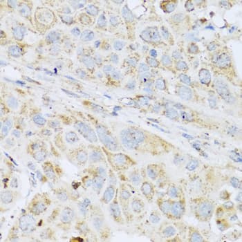 LYZ / Lysozyme Antibody