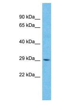 Polyclonal Rabbit anti-Human ZDHHC22 Antibody (aa214-263, WB)