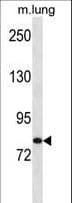 HUNK / B19 Antibody (aa467-496)