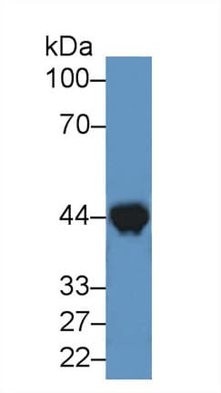 CKM / Creatine Kinase MM Antibody (aa11-367)