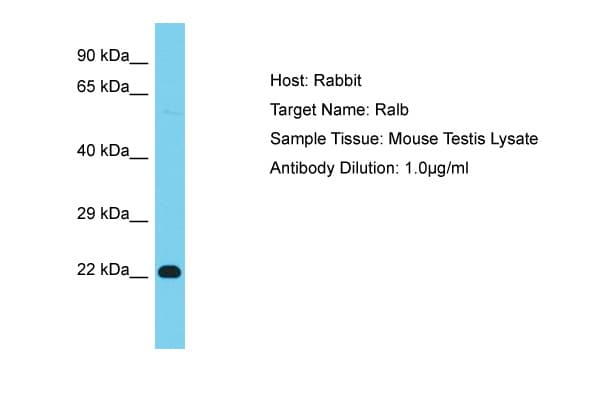 RALB Antibody (aa97-146)