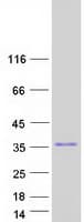 Human ZFAND5 Protein (Recombinant Myc-DDK (Flag))