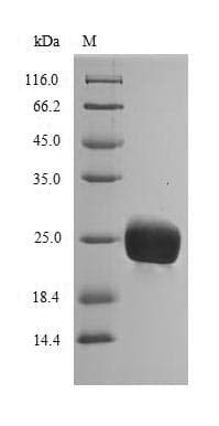 Rubber tree HEV1 Protein (Recombinant 6His, N-terminus)