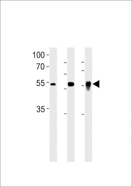 Polyclonal Rabbit anti-Human DMRTA2 Antibody (aa487-515, IF, WB)