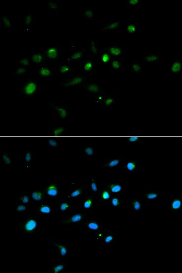 MURF1 / IRF Antibody