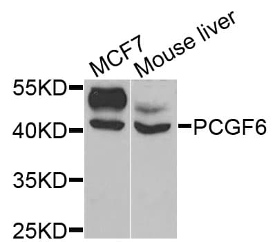 Polyclonal Rabbit anti-Human PCGF6 Antibody (IF, WB)