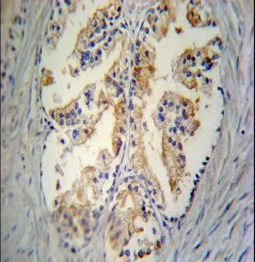 Polyclonal Rabbit anti-Human STC2 / Stanniocalcin 2 Antibody (aa273-302, IHC, WB)