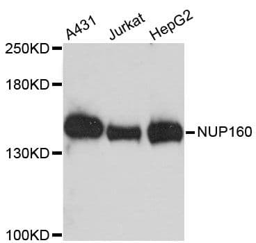 NUP160 Antibody