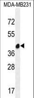 LRRC72 Antibody (aa193-221)