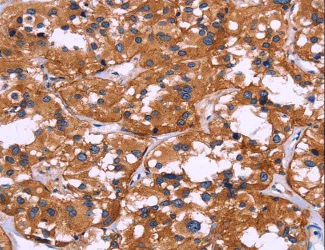 Polyclonal Rabbit anti-Human SYT4 Antibody (IHC)