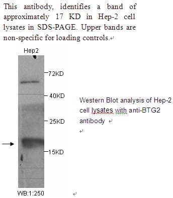 Polyclonal Rabbit anti-Human BTG2 Antibody (WB)