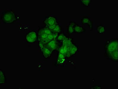 IHC-plus™ NUP210 / gp210 Antibody