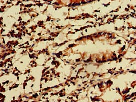 Polyclonal Rabbit anti-Human KIDINS220 / ARMS Antibody (IHC, IF, WB)