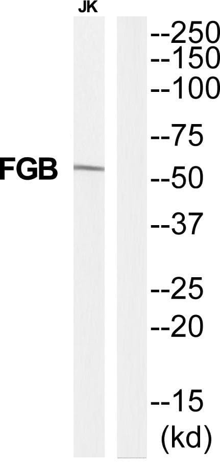 FGB / Fibrinogen Beta Chain Antibody