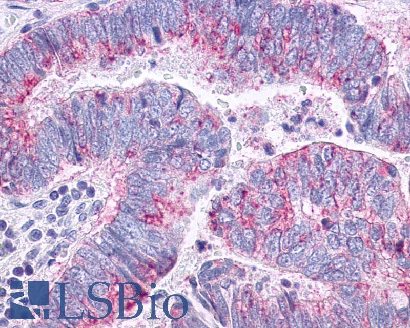 PathPlus™ Polyclonal Rabbit anti-Human CCR10 / GPR2 Antibody (C-Terminus, IHC)