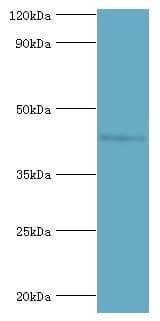 SIRT3 / Sirtuin 3 Antibody (aa20-130)