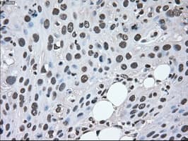 MAP2K2 / MKK2 / MEK2 Antibody (clone OTI8G6)