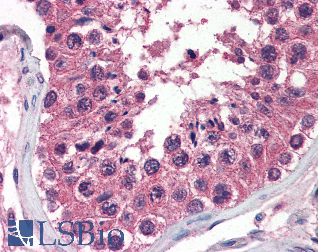 IHC-plus™ Monoclonal Mouse anti-Human UNG / Uracil DNA Glycosylase Antibody (clone K1C12, aa1-313, IHC, WB)