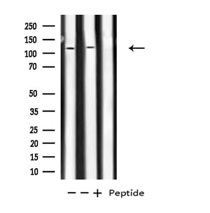 Polyclonal Rabbit anti-Human PKN1 Antibody (IF, WB)