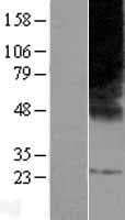 ELOVL3 Protein (Over-Expression Lysate Myc-DDK (Flag))