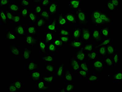 HIST1H2BN Antibody