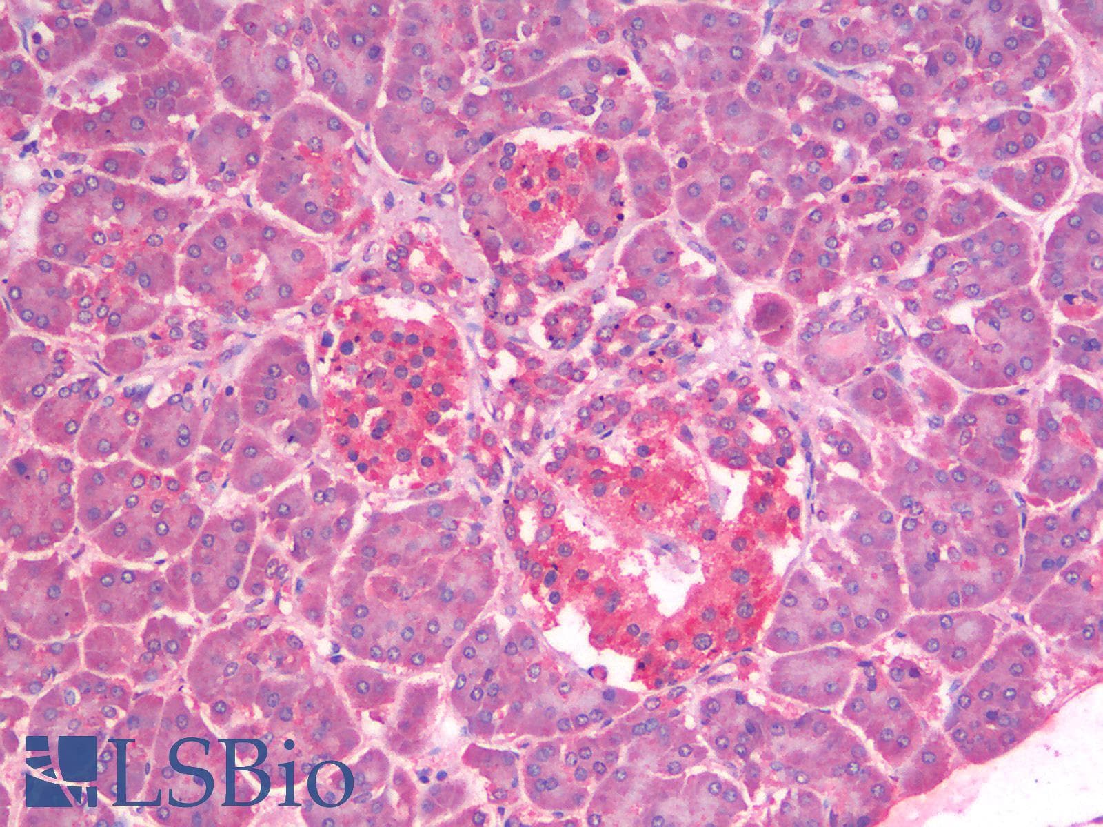 IHC-plus™ Polyclonal Rabbit anti-Human GLP1R / GLP-1 Receptor Antibody (Cytoplasmic Domain, IHC)