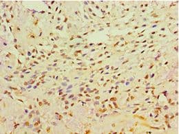 Polyclonal Rabbit anti-Human GRB4 / NCK2 Antibody (aa1-380, IHC, WB)