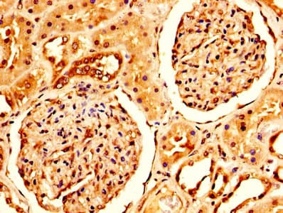 CRYAB / Alpha B Crystallin Antibody (aa1-175)