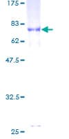Human TUBB4B / Tubulin Beta 4B Protein (Recombinant GST)