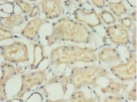 ACBD4 Antibody (aa1-305)