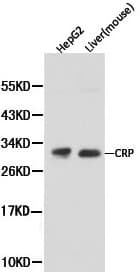 CRP / C-Reactive Protein Antibody