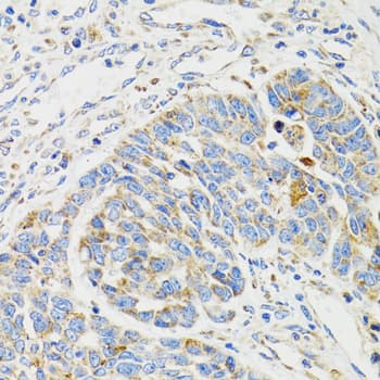 Polyclonal Rabbit anti-Human SH2B1 Antibody (IHC, IF, WB)