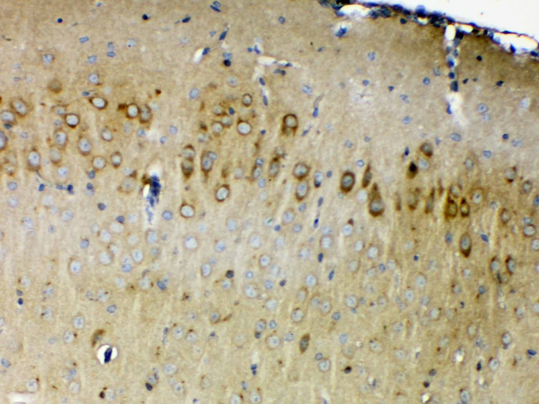 ERBB4 / HER4 Antibody