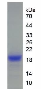 Pig ANGPTL4 Protein (Recombinant His)