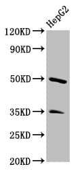PSPLA1 / Phospholipase A1 Antibody