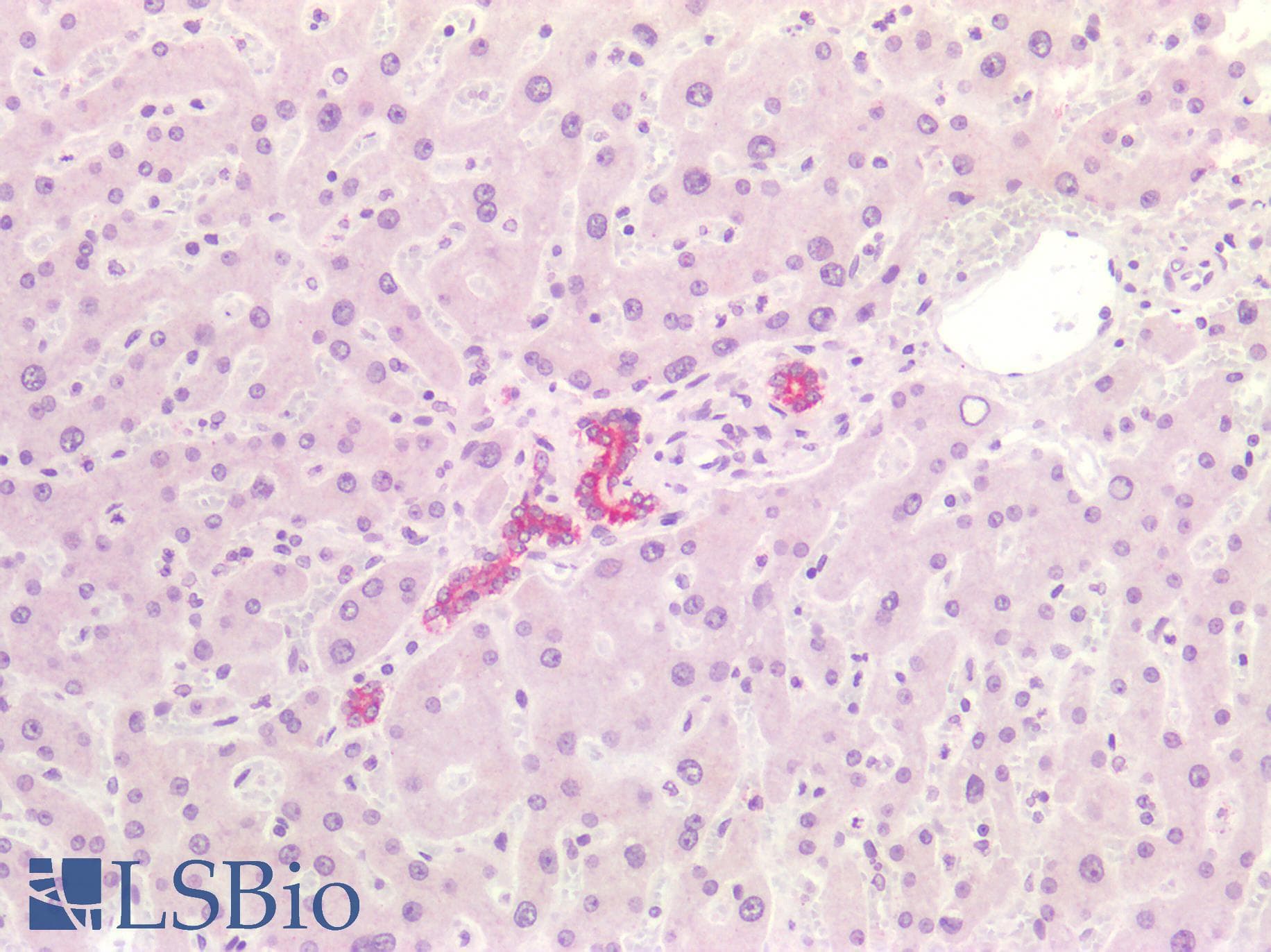 PathPlus™ KRT4 / CK4 / Cytokeratin 4 Antibody (clone 5H5)