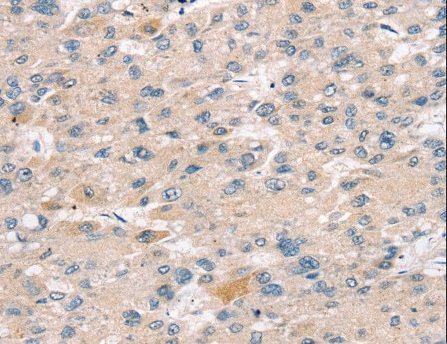 SULT2B1 / Sulfotransferase 2B1 Antibody