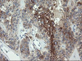 EIF5A2 Antibody (clone OTI6F7)